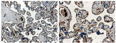 Anti-Angiopoietin 1 antibody [26B10] used in IHC (Paraffin sections) (IHC-P). GTX52472