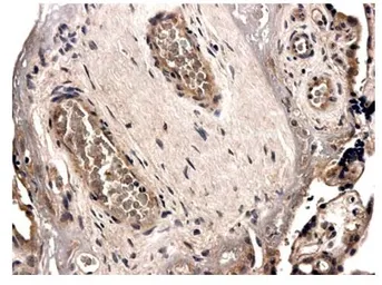 Anti-Angiopoietin 2 antibody [1F29] used in IHC (Paraffin sections) (IHC-P). GTX52473