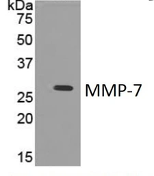 Anti-MMP7 antibody [4C21] used in Western Blot (WB). GTX52475