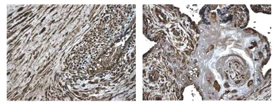 Anti-MMP8 antibody [7A11] used in IHC (Paraffin sections) (IHC-P). GTX52476