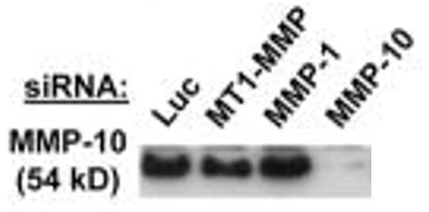 Anti-MMP10 antibody [9G10] used in Western Blot (WB). GTX52477