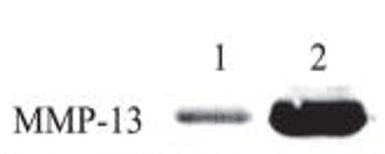 Anti-MMP13 antibody [12E10] used in Western Blot (WB). GTX52479