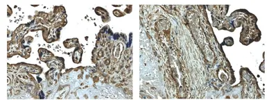 Anti-MMP14 antibody [9E10] used in IHC (Paraffin sections) (IHC-P). GTX52480