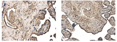 Anti-MMP25 antibody [2B5] used in IHC (Paraffin sections) (IHC-P). GTX52482