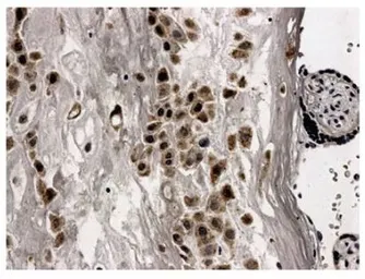 Anti-CD62E antibody [9E7] used in IHC (Paraffin sections) (IHC-P). GTX52484