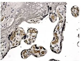 Anti-TIMP1 antibody [4A16] used in IHC (Paraffin sections) (IHC-P). GTX52486