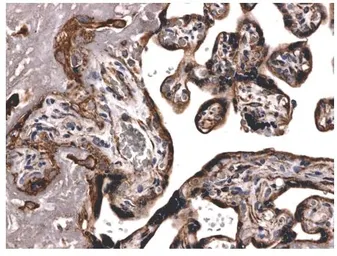 Anti-TIMP2 antibody [2C13] used in IHC (Paraffin sections) (IHC-P). GTX52487