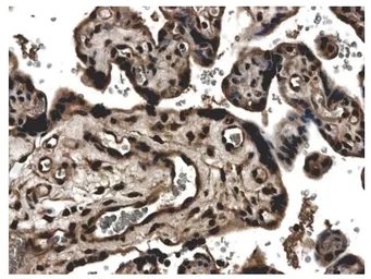Anti-TIMP3 antibody [7D3] used in IHC (Paraffin sections) (IHC-P). GTX52488