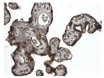 Anti-E-Cadherin antibody [21E9] used in IHC (Paraffin sections) (IHC-P). GTX52491