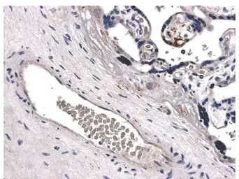 Anti-ABCG2 antibody [2J39] used in IHC (Paraffin sections) (IHC-P). GTX52498