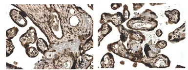 Anti-Activin Receptor Type IA antibody [9J17] used in IHC (Paraffin sections) (IHC-P). GTX52503