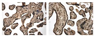 Anti-Activin Receptor Type IB antibody [11A7] used in IHC (Paraffin sections) (IHC-P). GTX52505