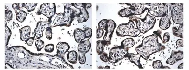 Anti-BMPR1B antibody [3E12] used in IHC (Paraffin sections) (IHC-P). GTX52506
