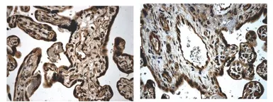 Anti-TGF beta Receptor III antibody [5G9] used in IHC (Paraffin sections) (IHC-P). GTX52508