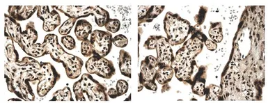 Anti-Activin Receptor Type IIA antibody [6J16] used in IHC (Paraffin sections) (IHC-P). GTX52509