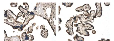 Anti-Activin Receptor Type IIB antibody [6L11] used in IHC (Paraffin sections) (IHC-P). GTX52510