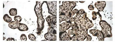Anti-BMPR2 antibody [9A10] used in IHC (Paraffin sections) (IHC-P). GTX52511