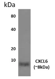 Anti-GCP2 antibody [10L25] used in Western Blot (WB). GTX52670