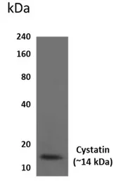 Anti-Cystatin A antibody [2D26] used in Western Blot (WB). GTX52680