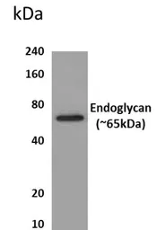 Anti-PODXL2 antibody [7R2] used in Western Blot (WB). GTX52711