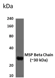 Anti-HGFL beta antibody [9D24] used in Western Blot (WB). GTX52817