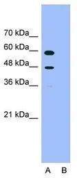 Anti-PDCD4 antibody, N-term used in Western Blot (WB). GTX52831