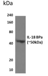 Anti-IL18BP antibody [10G36] used in Western Blot (WB). GTX52833