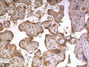 Anti-IL20 Receptor alpha antibody [9F40] used in IHC (Paraffin sections) (IHC-P). GTX52848