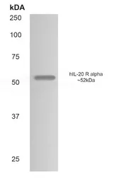 Anti-IL20 Receptor alpha antibody [9F40] used in Western Blot (WB). GTX52848