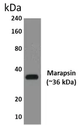 Anti-Marapsin antibody [3H15] used in Western Blot (WB). GTX52918