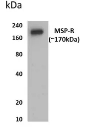 Anti-RON antibody [10F24] used in Western Blot (WB). GTX52933