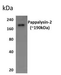 Anti-Pappalysin 2 antibody [8M12] used in Western Blot (WB). GTX52960