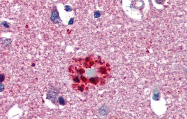Anti-TCF21 antibody, N-term used in IHC (Paraffin sections) (IHC-P). GTX52981