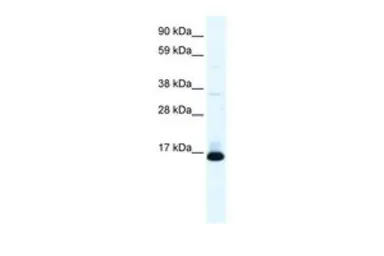 Anti-TCF21 antibody, N-term used in Western Blot (WB). GTX52981