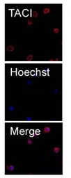 Anti-TACI antibody [9D22] used in Immunocytochemistry/ Immunofluorescence (ICC/IF). GTX53017