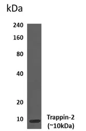 Anti-Elafin antibody [1A9] used in Western Blot (WB). GTX53037