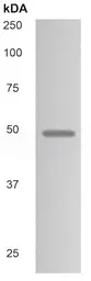 Anti-TACSTD2 antibody [49D6] used in Western Blot (WB). GTX53043