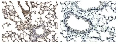 Anti-VEGF Receptor 1 antibody [5F13] used in IHC (Paraffin sections) (IHC-P). GTX53092
