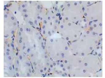 Anti-VEGF Receptor 2 antibody [6C23] used in IHC (Paraffin sections) (IHC-P). GTX53094