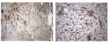 Anti-VEGF Receptor 3 antibody [5F63] used in Immunohistochemistry (IHC). GTX53095