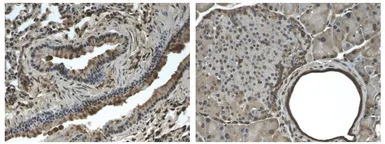 Anti-PDGF Receptor beta antibody [4C54] used in IHC (Paraffin sections) (IHC-P). GTX53097