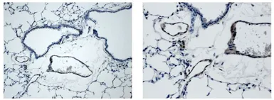 Anti-VEGFD antibody [8C35] used in IHC (Paraffin sections) (IHC-P). GTX53098