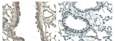 Anti-VEGFB antibody [6E72] used in IHC (Paraffin sections) (IHC-P). GTX53099
