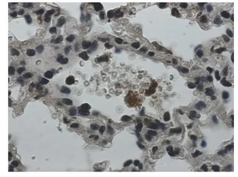 Anti-IL1 Receptor 1 antibody [11B7] used in IHC (Paraffin sections) (IHC-P). GTX53104