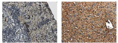 Anti-IL1 Receptor 2 antibody [7D7] used in IHC (Paraffin sections) (IHC-P). GTX53105
