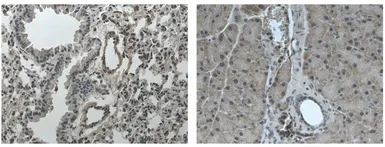 Anti-TrkC antibody [6G17] used in IHC (Paraffin sections) (IHC-P). GTX53108