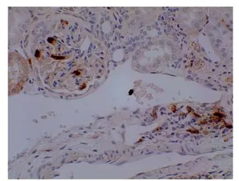 Anti-Neutrophils antibody [3G23] used in IHC (Paraffin sections) (IHC-P). GTX53119