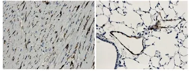 Anti-CD62E antibody [9J12] used in IHC (Paraffin sections) (IHC-P). GTX53125