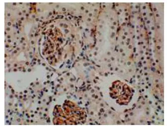 Anti-CD62E antibody [9J12] used in IHC (Paraffin sections) (IHC-P). GTX53125