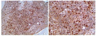 Anti-CD8 alpha antibody [MAB0708] used in IHC (Paraffin sections) (IHC-P). GTX53126